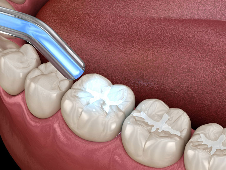 More Than Just a Quick Fix